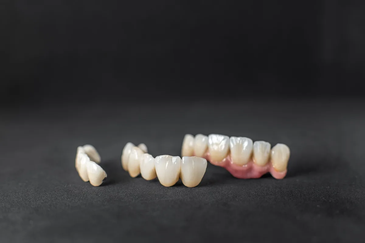 dental crowns for front teeth