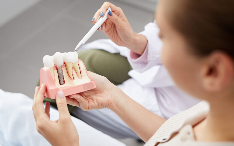Dental Implants Improve Digestion