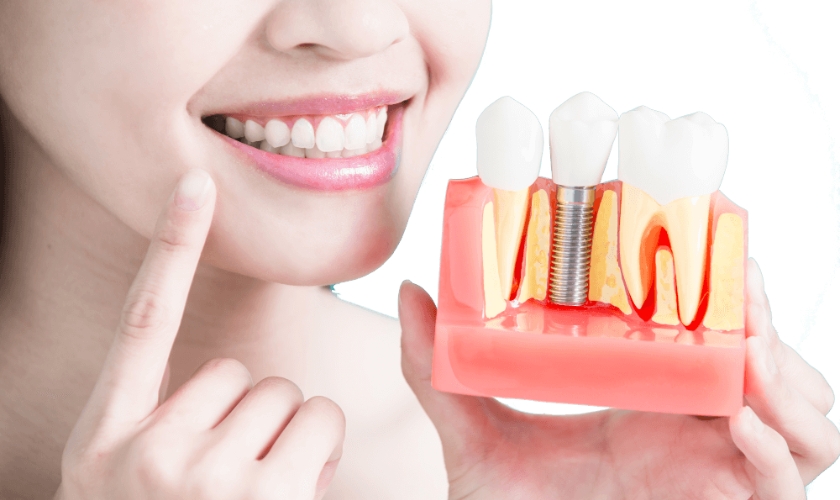 Dental Implant Failures