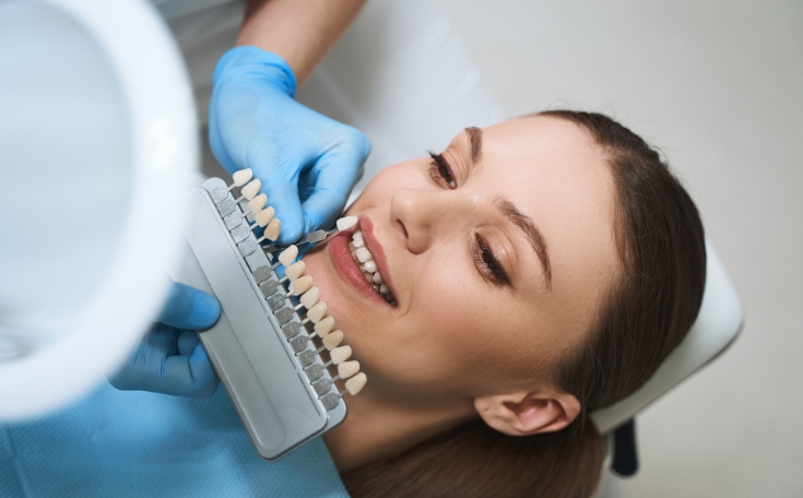 Veneers