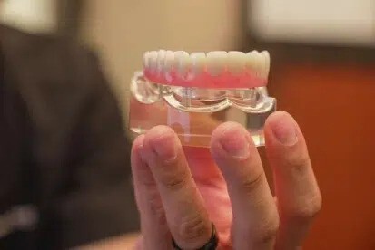 Dental implant upland tooth model held during consultation